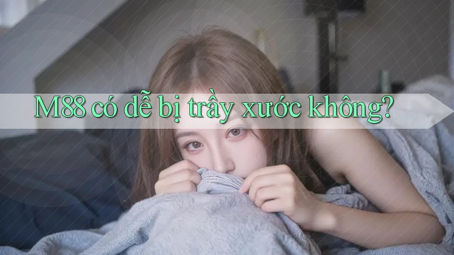 M88 có dễ bị trầy xước không?